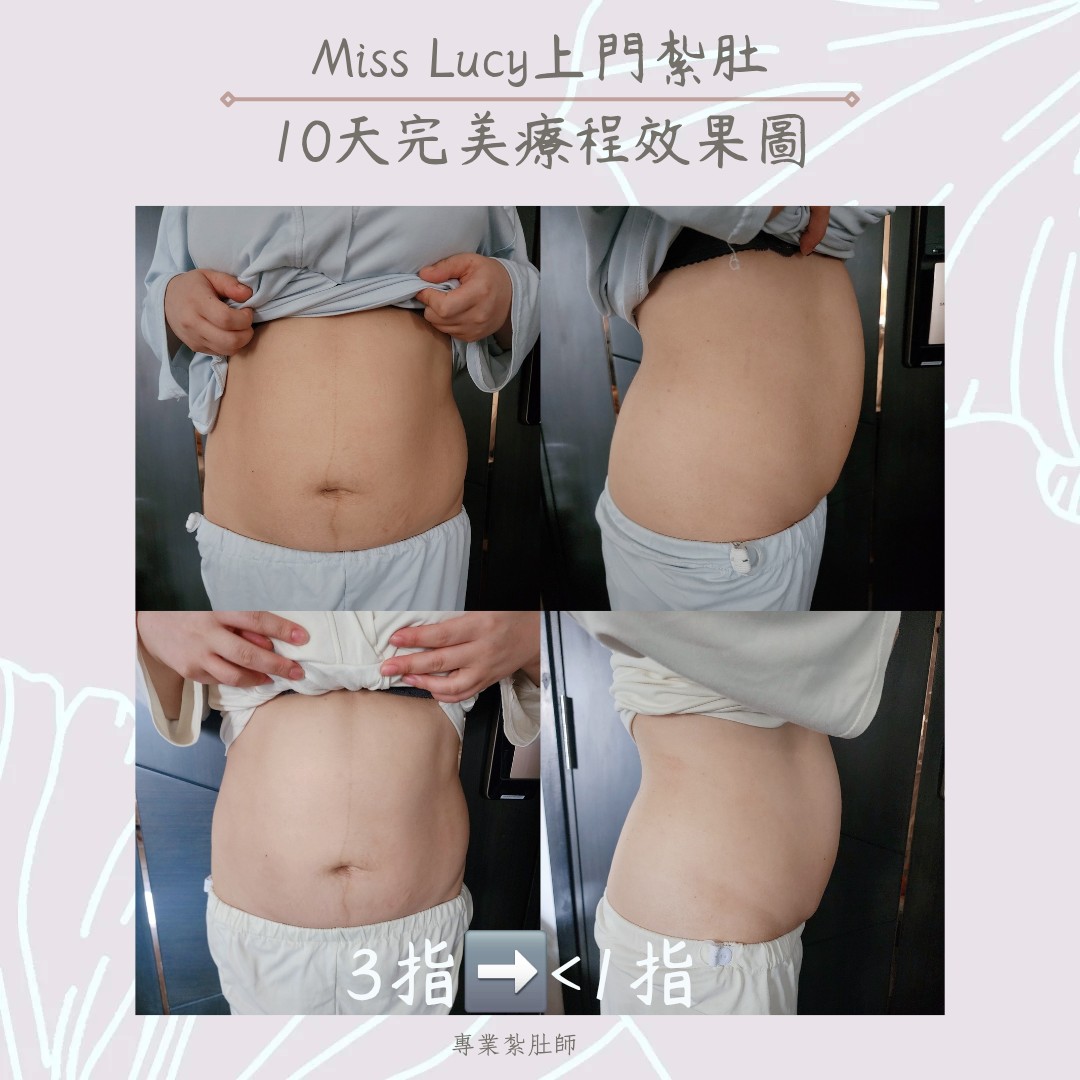 Miss Lucy 上門紮肚療程效果圖 2