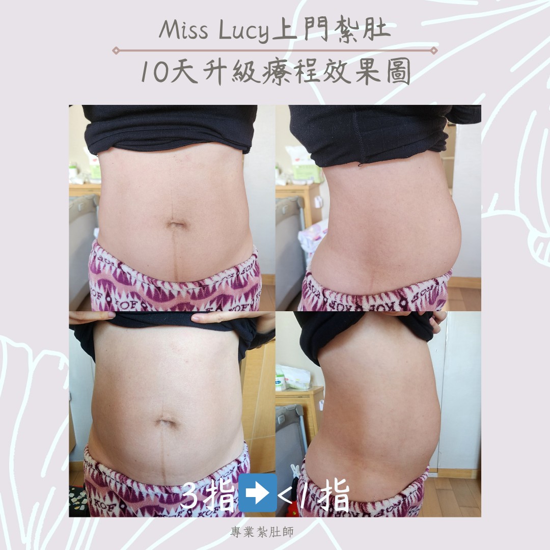 Miss Lucy 上門紮肚療程效果圖 5