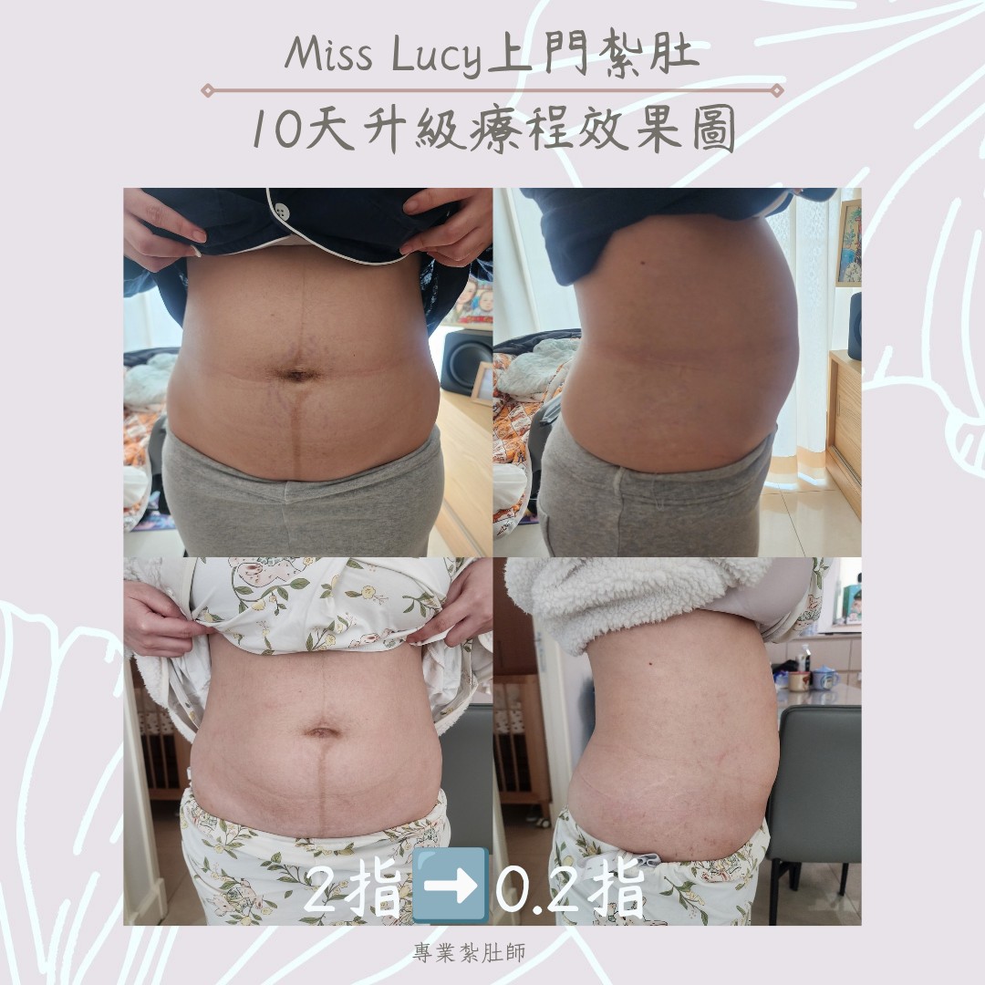 Miss Lucy 上門紮肚療程效果圖 7