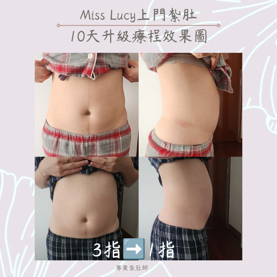 Miss Lucy 上門紮肚療程效果圖 9