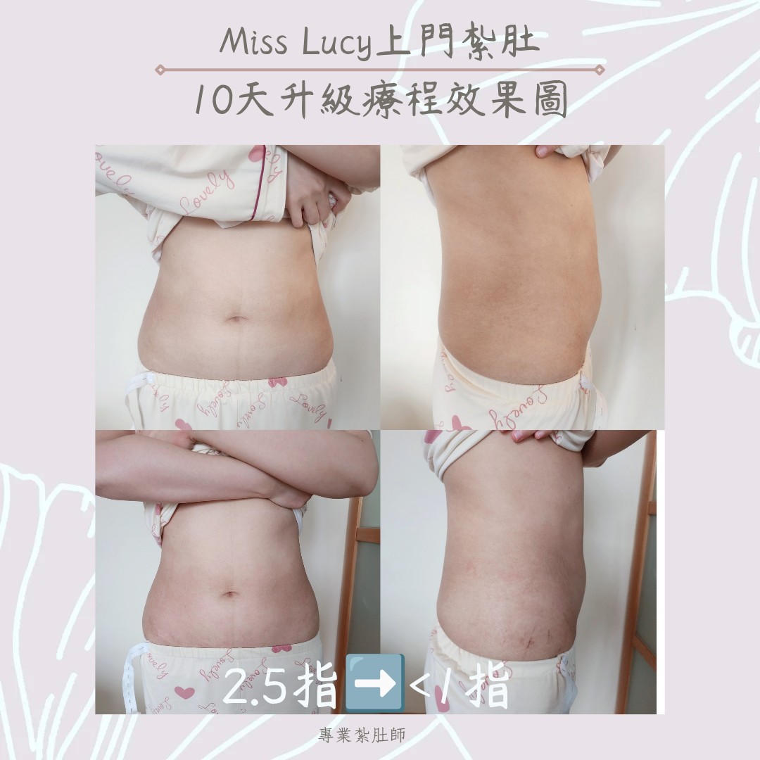 Miss Lucy 上門紮肚療程效果圖 10