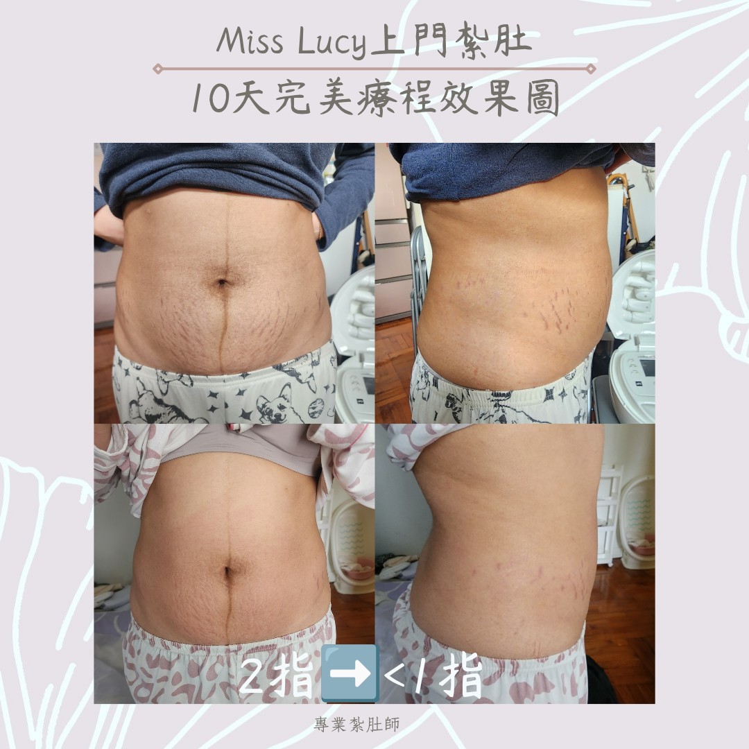Miss Lucy 上門紮肚療程效果圖 12