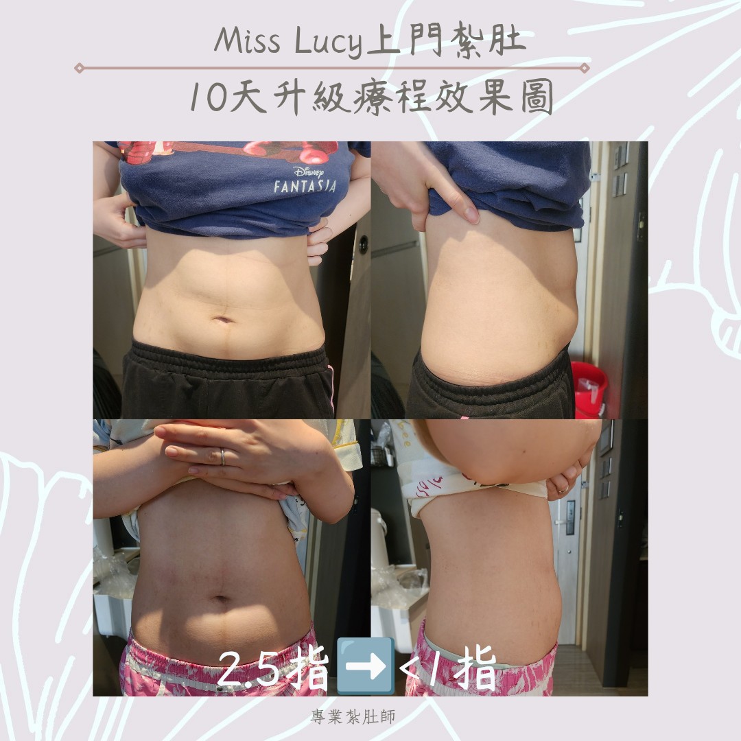 Miss Lucy 上門紮肚療程效果圖 17