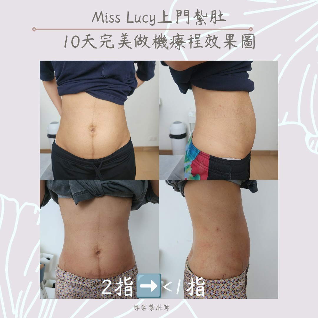 Miss Lucy 上門紮肚療程效果圖 19