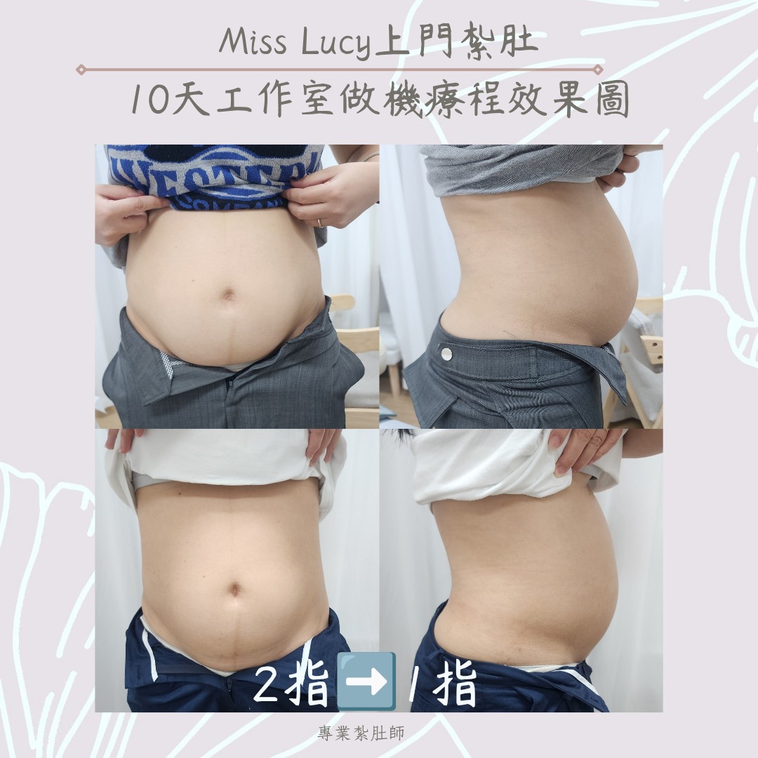 Miss Lucy 上門紮肚療程效果圖 23